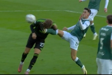 No chance of winning the ball (as behind Engels), full speed lunge resulting in a kick to the face and opponent's nose burst open...

SERIOUS questions to be asked of the SFA referees who didn't consider this a red. 

Ticks every box of Serious Foul Play.