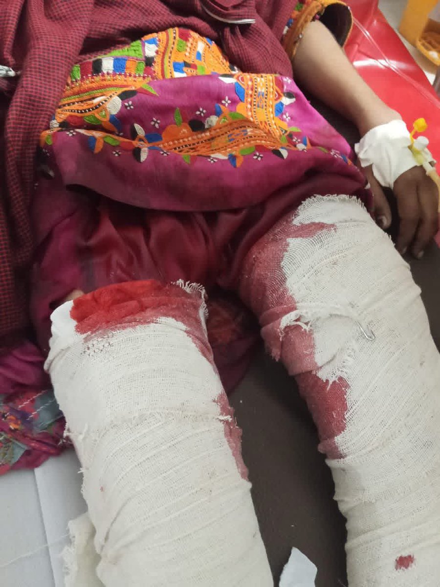 اے ھوناں کئے بُہ موکیت؟
#StopBalochGenocide