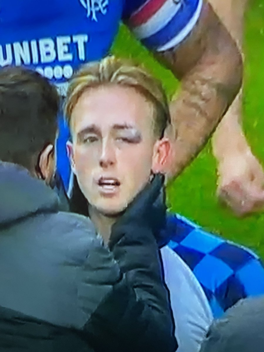 KBG1888's tweet image. Miller elbowed in the face. McLean gives Huns a foul. VAR ignores it!