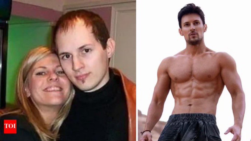 akramcodez's tweet image. work hard guys your hair will grow again