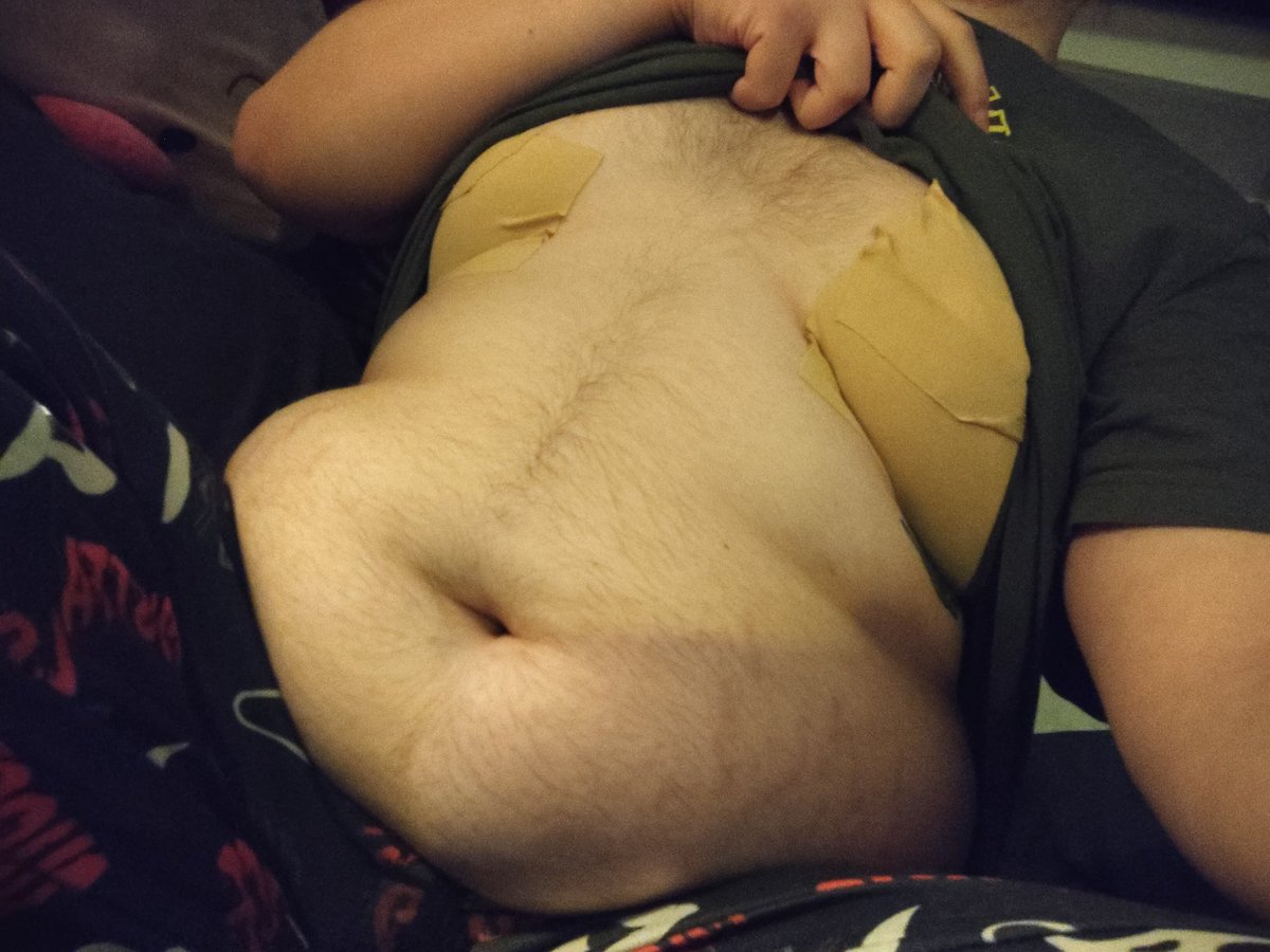 viscera/encepha tweet media