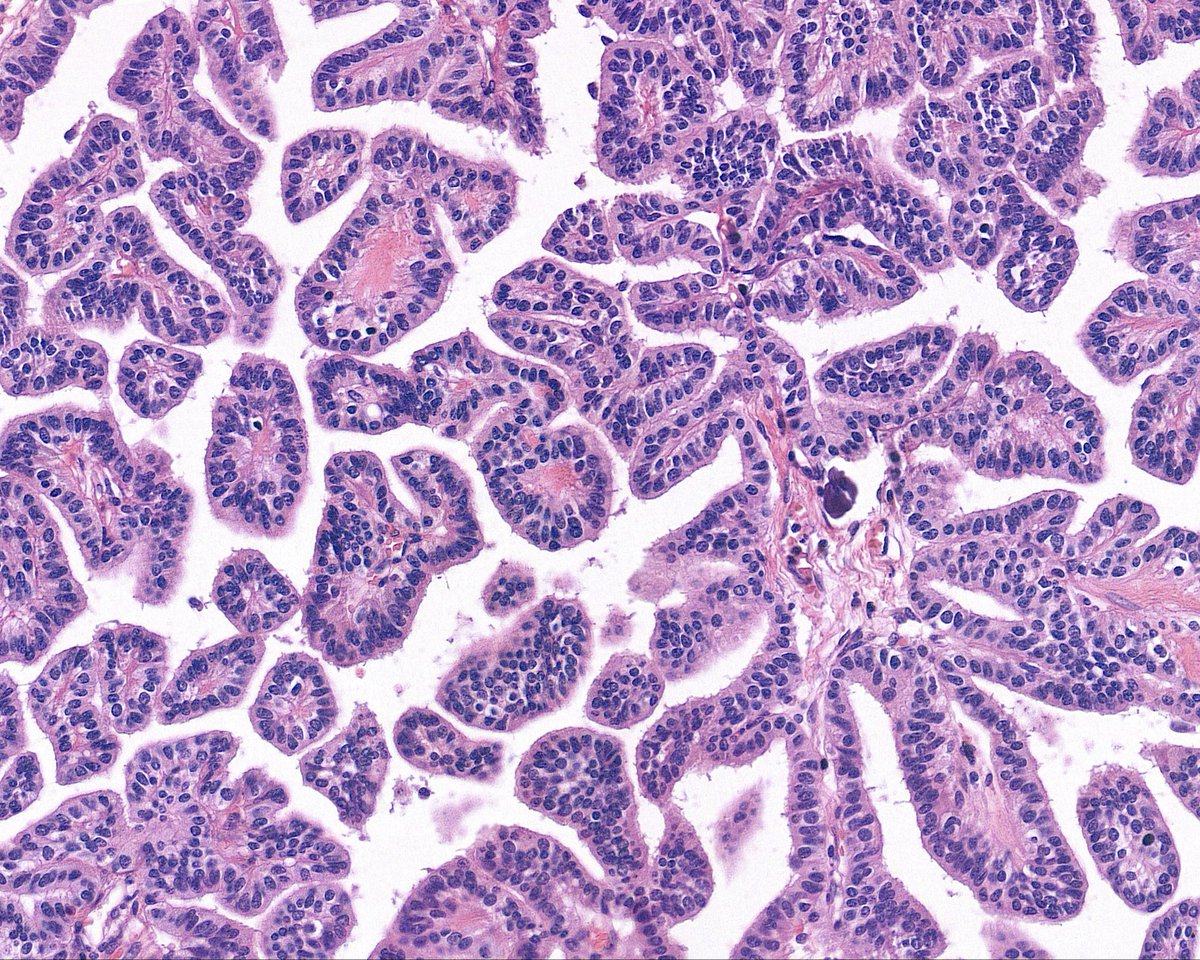 Surgical Pathology Cases tweet media