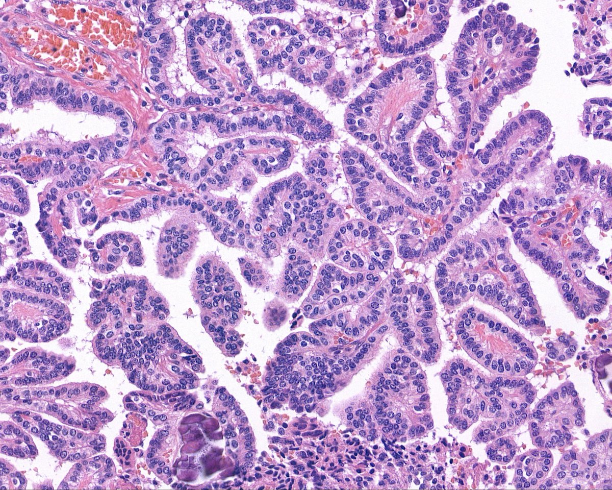 Surgical Pathology Cases tweet media