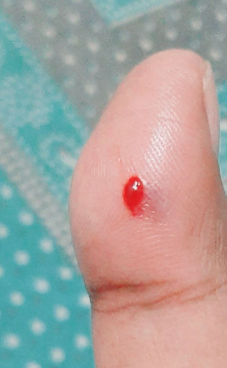 AvinashYadavSP4's tweet image. जिंदगी तू इतना रूलाती क्यों हैं...?

कभी-कभी बड़ी से बड़ी बात से भी फ़र्क नहीं पड़ता, तो कभी-कभी किसी की छोटी से छोटी बात तकलीफ़ पहुंचा देती  हैं...

ठीक इस चोट की तरह छोटी और ख़ास तकलीफदेह होती हैं, किसी की छोटी-छोटी बातें.....😌😥😭

#HeartFullyLife
#Mindpeace
#เกมรักลวงตอนจบ