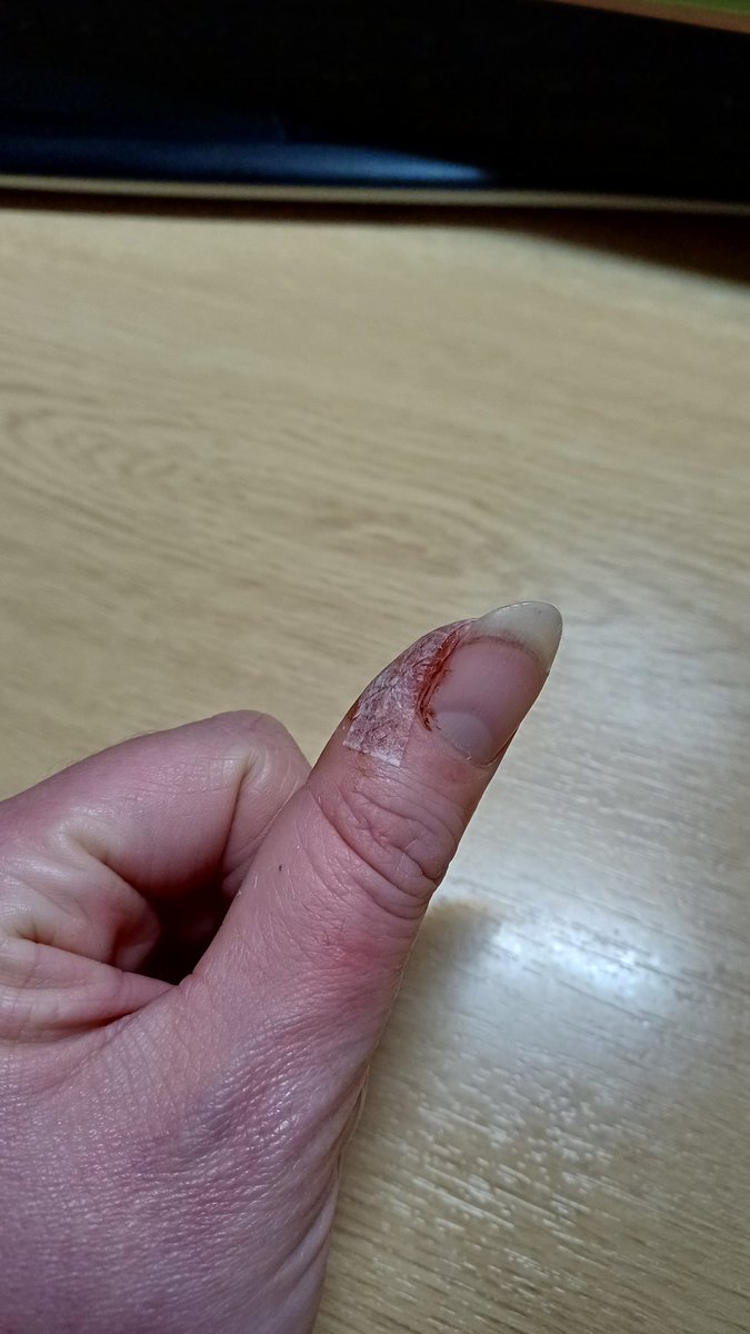NaturaEmporium's tweet image. Sorry if you are a bit squeamish. 
I figured it wasn&apos;t enough to cut the tip of my thumb off, I&apos;ll trap the middle finger on the same hand as well...I mean why not 🤦‍♀️😫🤣
#sundayvibes