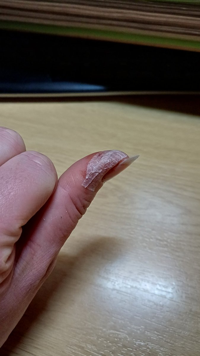 NaturaEmporium's tweet image. Sorry if you are a bit squeamish. 
I figured it wasn&apos;t enough to cut the tip of my thumb off, I&apos;ll trap the middle finger on the same hand as well...I mean why not 🤦‍♀️😫🤣
#sundayvibes