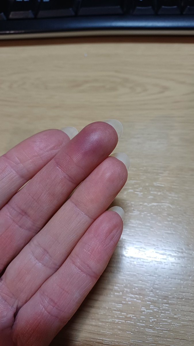 NaturaEmporium's tweet image. Sorry if you are a bit squeamish. 
I figured it wasn&apos;t enough to cut the tip of my thumb off, I&apos;ll trap the middle finger on the same hand as well...I mean why not 🤦‍♀️😫🤣
#sundayvibes