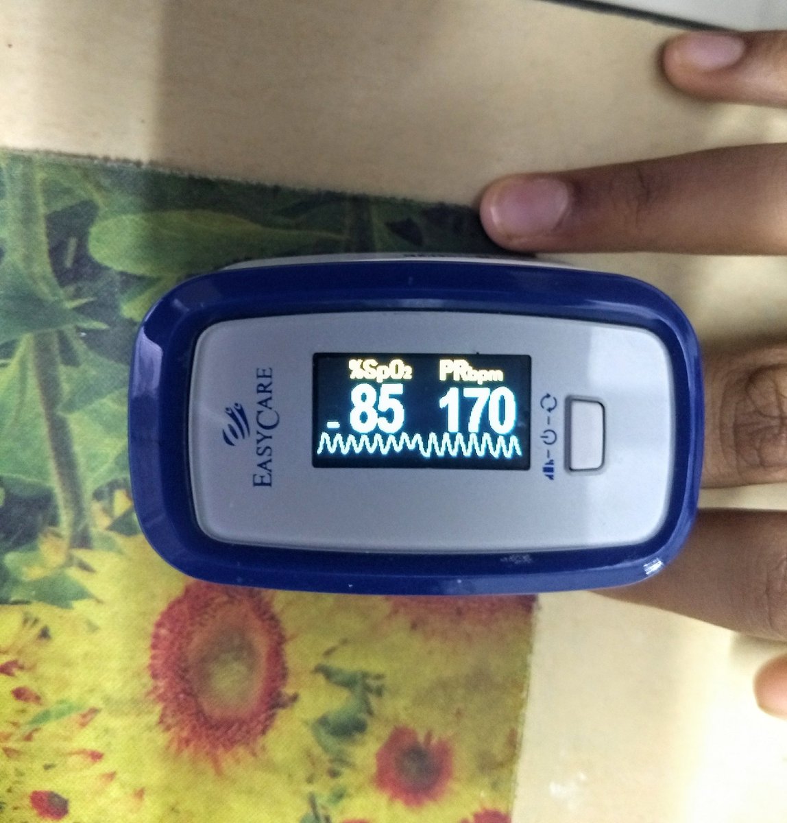 Few observations almost ALL had concurrent infection with lung involvement,8-9/12 per week were women,ALL had some form or the other of STRESS,None had regular exercise routine,90% were in 20-45 age group  #Medtw