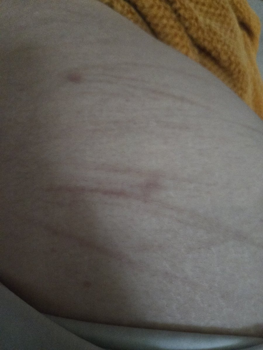 Zayasaurus's tweet image. healed (⁠ ⁠◜⁠‿⁠◝⁠ ⁠)⁠♡