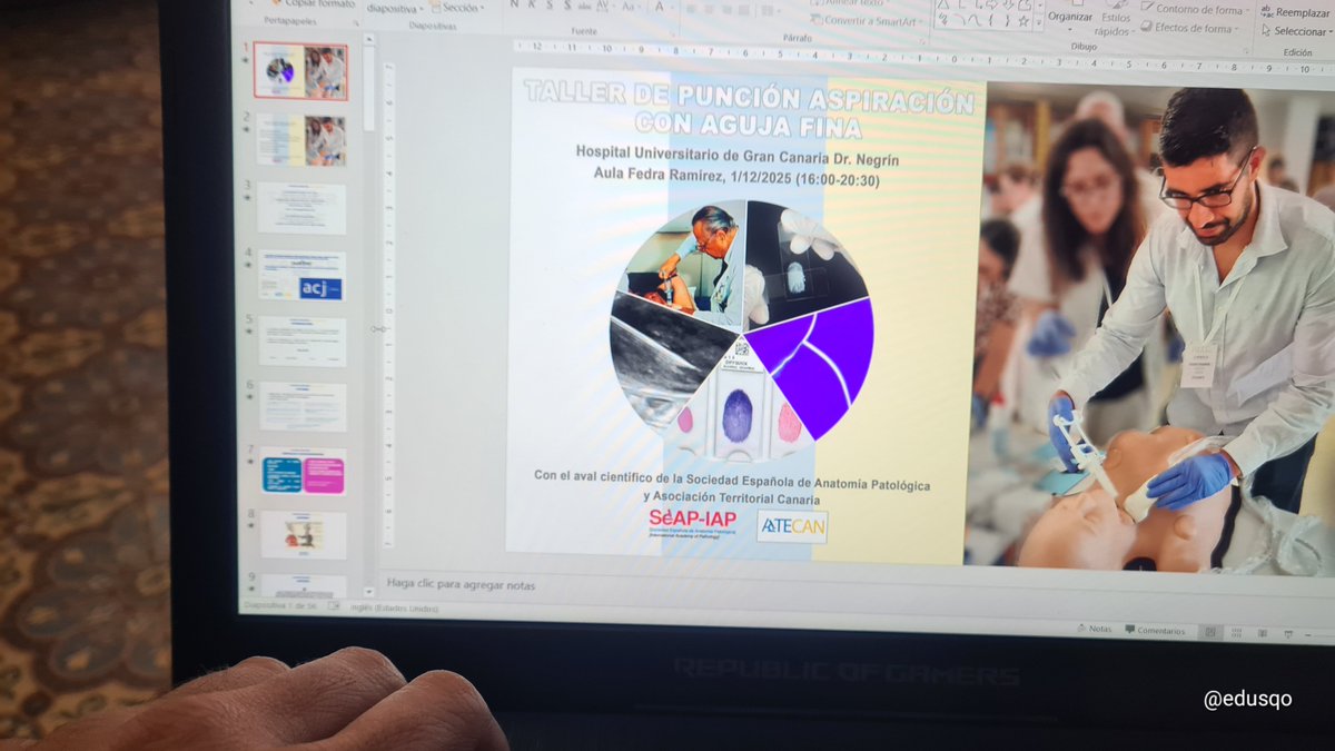 edusqo's tweet image. Ultimando el taller de mañana de #PAAF en el Hospital Dr. Negrín de Las Palmas:
▫️Introducción al procedimiento 
▫️Historia
▫️Técnica y variaciones
▫️Evaluación in situ
▫️Ventajas y limitaciones
▫️Abordaje ecoguiado
▫️Complicaciones
▫️Casuistica interactiva
#MedEd #Citología #Dx