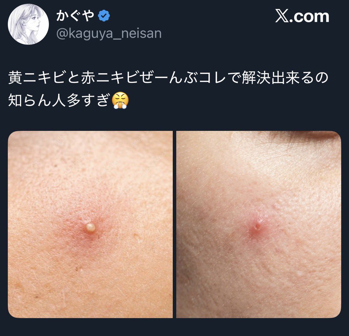 1234_ssbu's tweet photo. 一瞬乳首やと思った https://t.co/m7H9L1aVoM