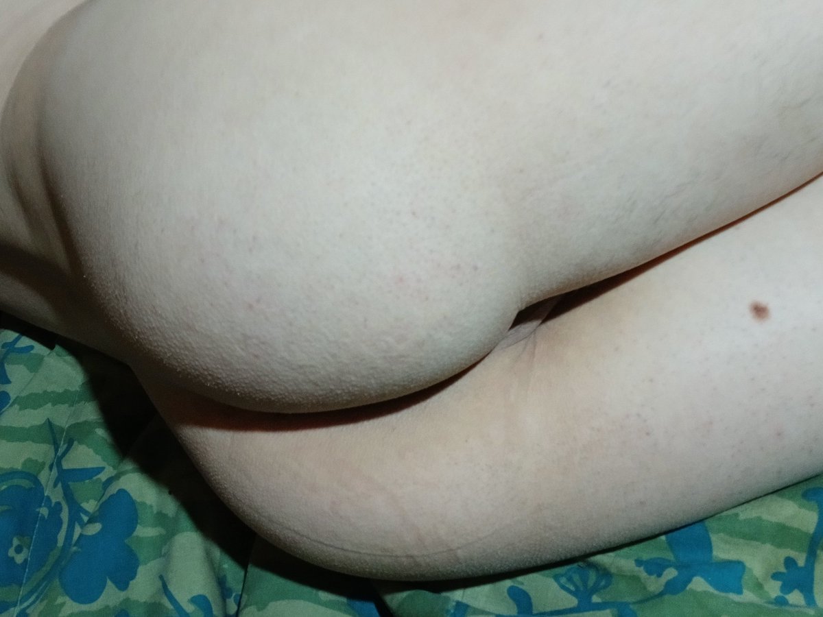 🍑🔥