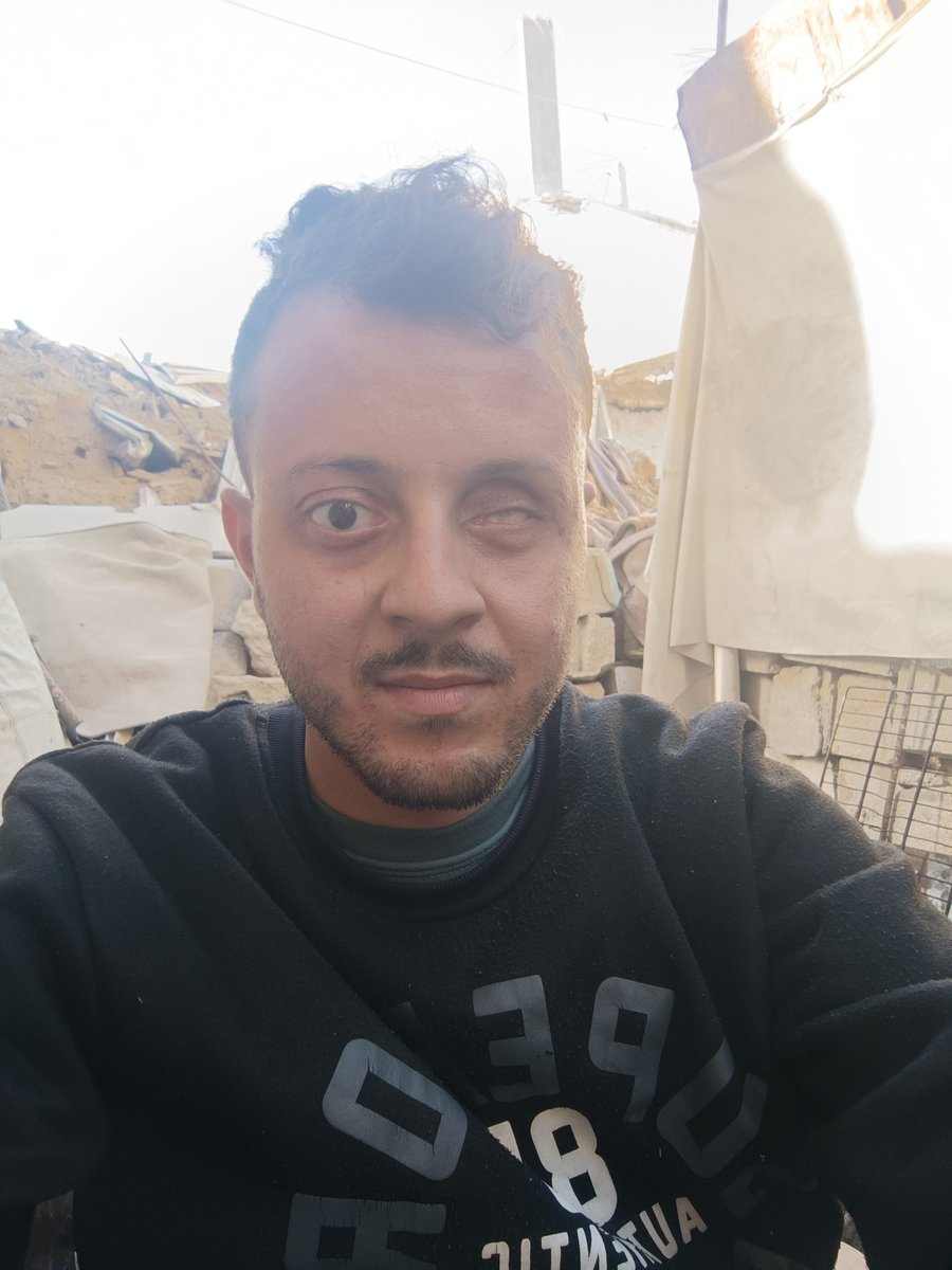 I live my worst times ever!

I Lost My Eye, &amp; my father died from Leukemia, also I lost my work centre, Sorry for bothering you; I really need your help, &amp; I don't have any other choices.

IF YOU CARE, Please DONATE and REPLY with a dot..
paypal.me/ahmedshamia