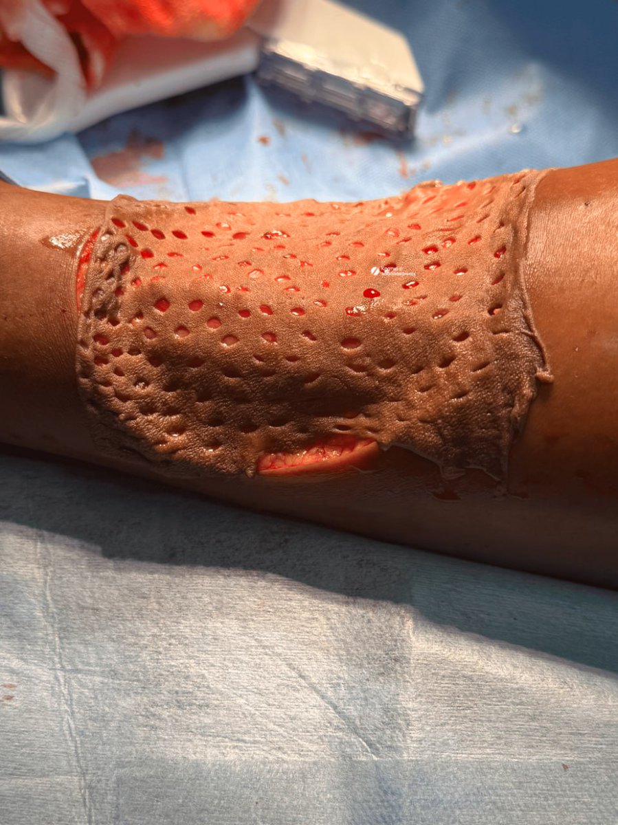 IhabFathiSulima's tweet image. What has happened?