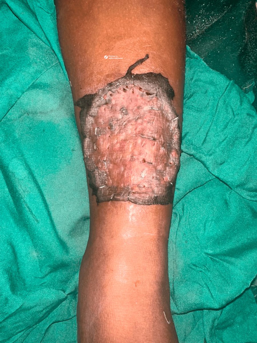 IhabFathiSulima's tweet image. What has happened?