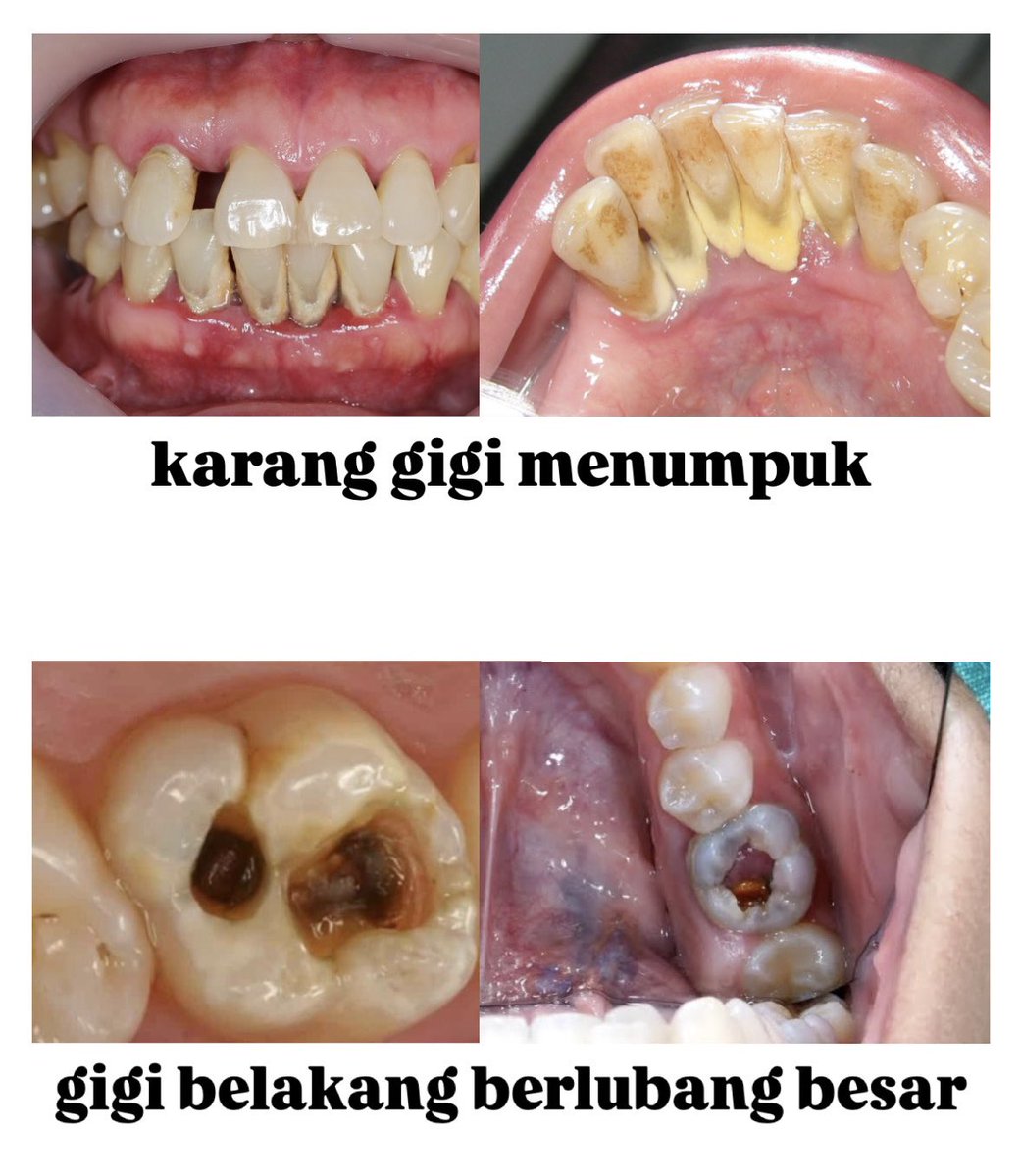Koas Gigi Jakpus Salemba dan Sekitarnya tweet media