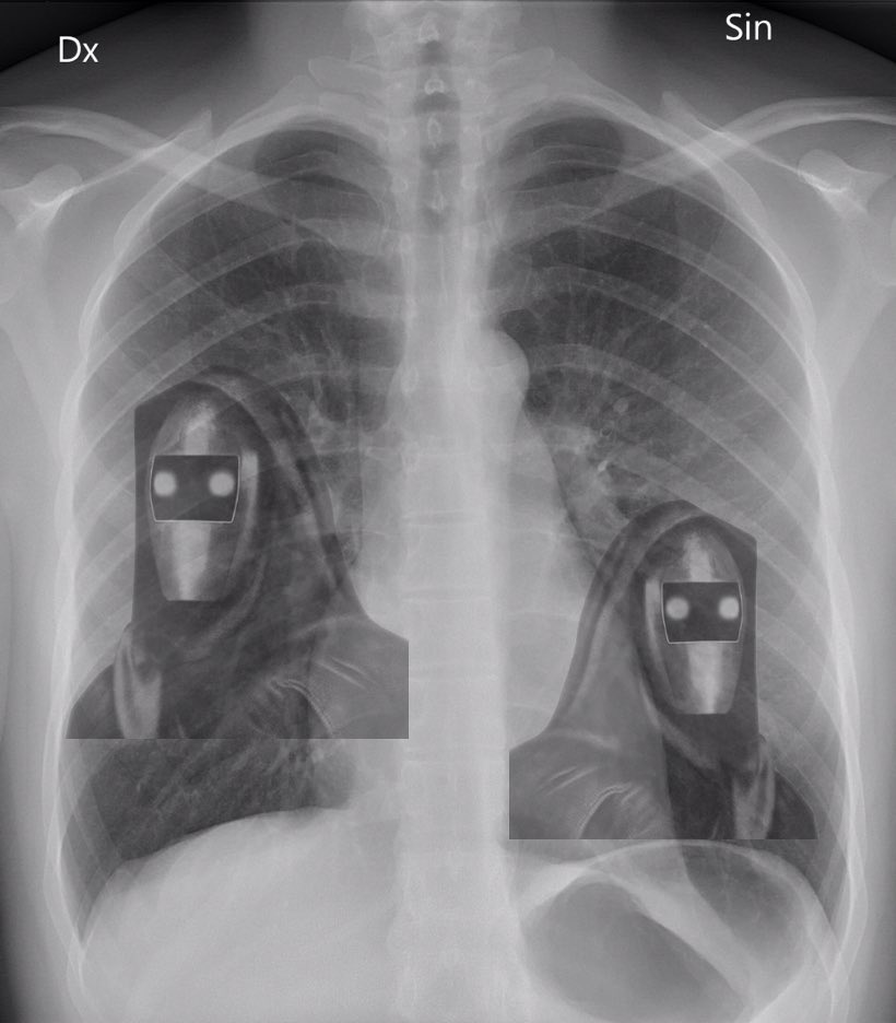 Zooko’s got that futard in him.