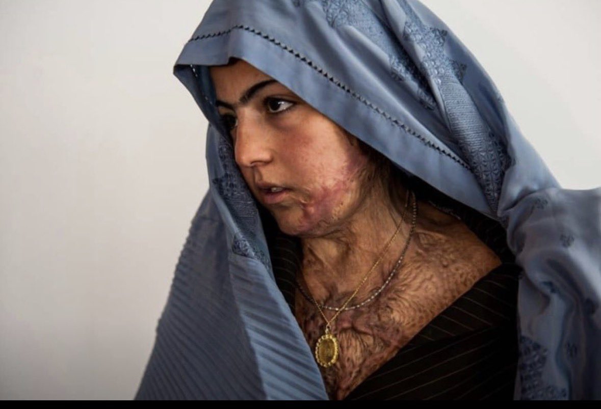 WDIAfghanistan1's tweet image. She stayed silent, not because it didn’t hurt ٫but because no one listened when she cried💔.
This stuation and story of 1000+  Afghan women under the taliban control even before the taliban control 💔😡