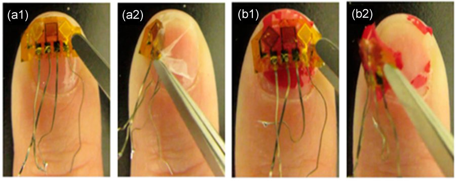 MDPIEngineering's tweet image. Healthcare Wearable Sensors Adhesion to Human Fingernails and Toenails

mdpi.com/2072-666X/15/1…

#wearable #sensor