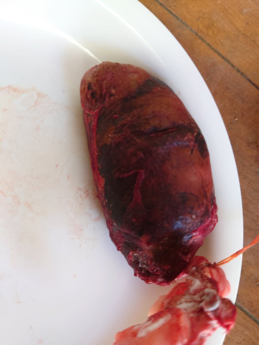 クマのたんのう RT @2324SORI: これが熊の胃『胆のう』です。今の緊急駆除で胆のうの