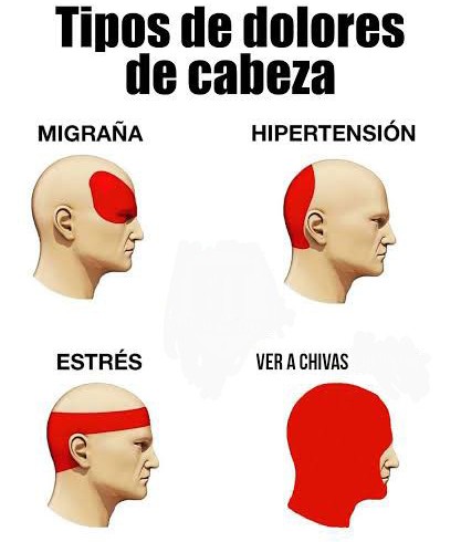 Esta eliminatoria deja dos cosas.

Milito la pauneo, y Javier por qué cobro el penal?

En fin, no esperaba mucho del Guadalajara para este apertura, después que se batalló desde la elección del dt.
Sin embargo me parece que es el camino correcto.

Chivas, te amo pese todo.