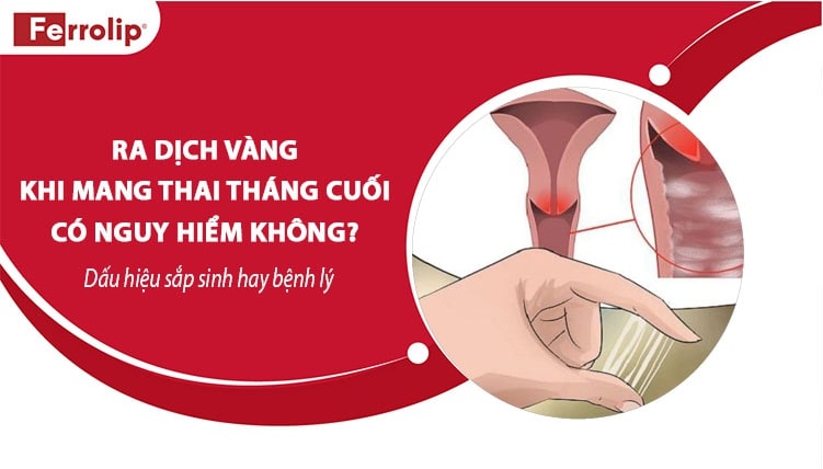 dsminhferrolip's tweet image. Ra dịch vàng khi mang thai tháng cuối có nguy hiểm không – Dấu hiệu sắp sinh hay bệnh lý?

➡️➡️➡️ferrolip.vn/ra-dich-vang-k…

#ferrolipbau #ferrolip #satbaovinang #xegoitrungvang #satfebaufe