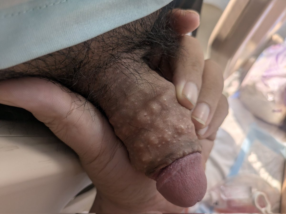 Hli2sSP8SrNy1Uk's tweet photo. 今天來探病的朋友
有一隻好可怕的兇器...
讓你們看看8萬塊打造的狼牙棒...
口感觸感超級特別的...
好喜歡喔... https://t.co/o81LodTni6