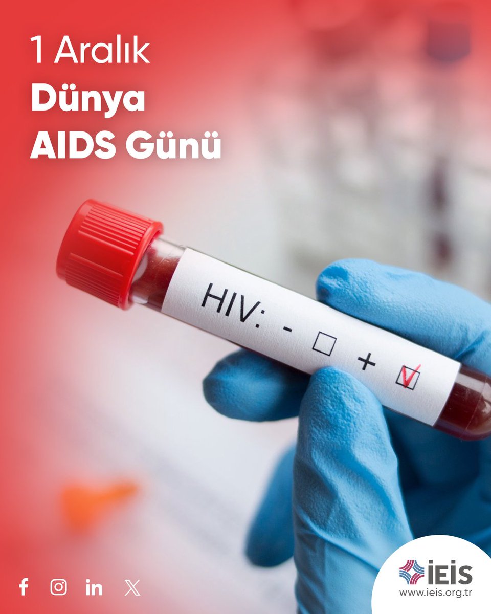 HIV/AIDS, tüm dünyayı etkileyen kapsamlı bir toplum sorunudur. Erken tanı, hayat kurtarır. Toplumun bilinçlenmesi, önyargıların yıkılması ve hastaların desteklenmesi, ortak geleceğimiz için en büyük bir gerekliliktir.

​#dünyaaidsgünü #hiv #aids