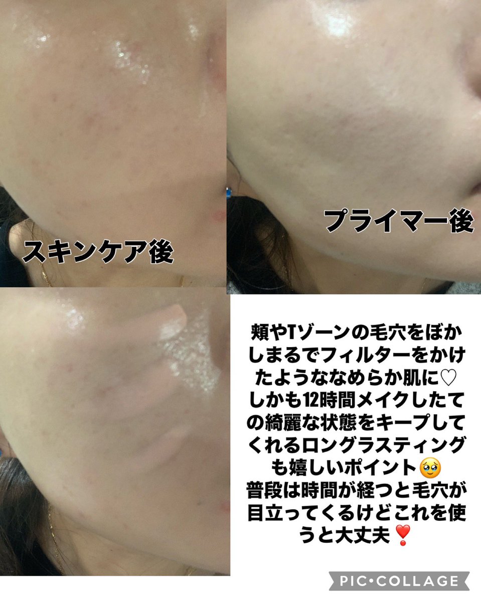 ちひろ🧸🍓 (@pomu62255) / Posts / X