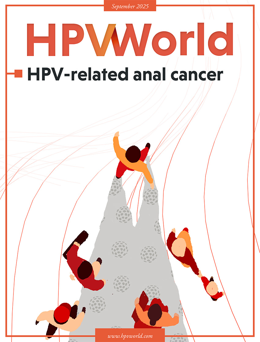 HPV-related anal cancer is an emerging public health issue. This publication highlights recent progress and strategies for prevention and management. Thanks to the authors for their valuable contributions. Read more: hpvworld.com/info/index184.… #HPV #AnalCancer #Prevention