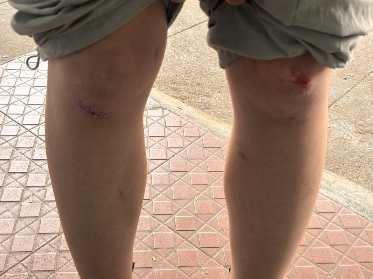 doskoijourney's tweet photo. 今道端ですっ転んだらトゥクトゥクのおっちゃんたちがわらわら集まってきて「ありがと〜」言われた。わかる日本語をとりあえず言ったんだと思うけど煽られてる日本人の構図になった。そしてズボン穴空いた、、 https://t.co/xLiyUkMWk1