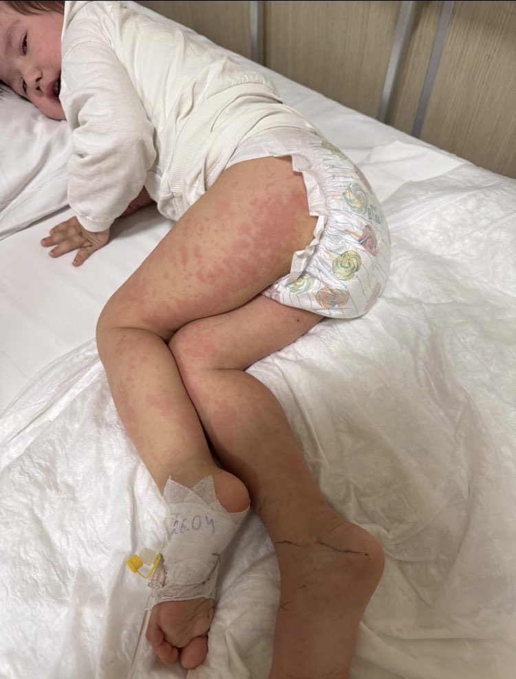 <a href="/dincerazaphangs/">Dinçer Azaphan 🇹🇷</a> <a href="/gagahaberyeni/">GaGa Haber</a> <a href="/HatayValiligi/">T.C. Hatay Valiliği</a> <a href="/HatayBSB/">Hatay Büyükşehir Belediyesi</a> Selamlar saygılar Kiymetli Dostum Bu çocuk Hacettepe hastanesinde yatıyor durumuları iği değil Ak deniz Ateşi Tesisi Konuşmuş doktor KİNERET iğnesi yazmış almaya imkanları yoxdu Allah rızası için yardımcı olurmusun Kral Abim