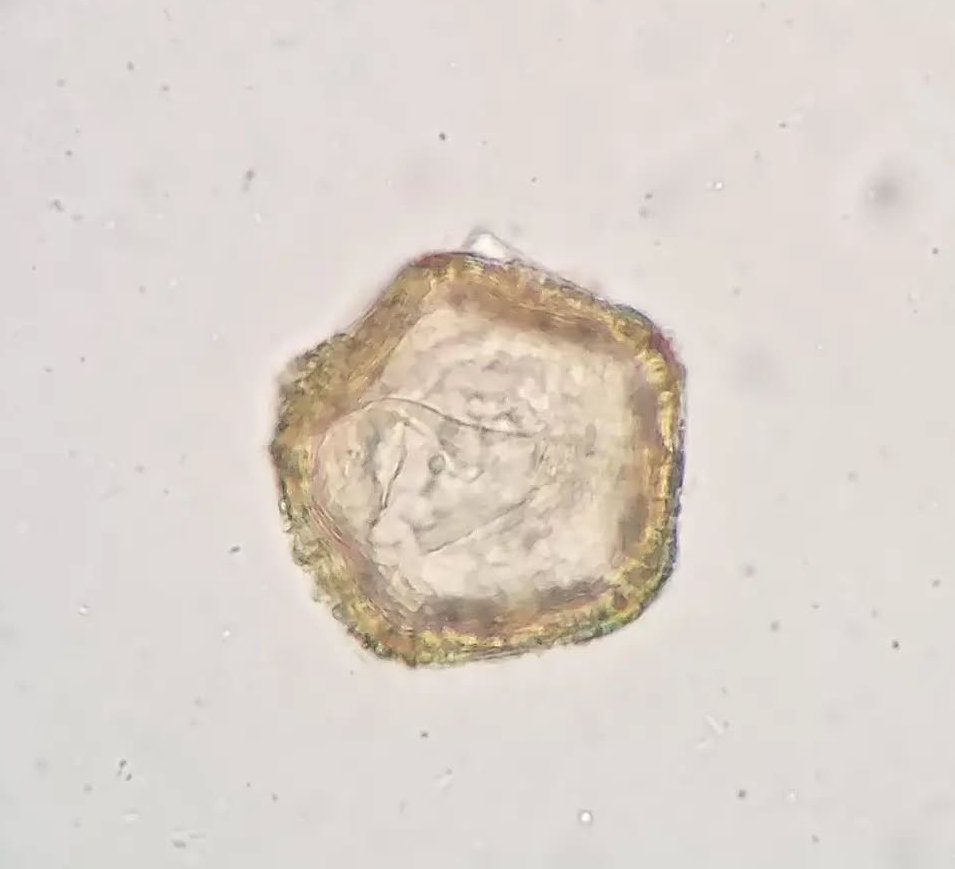 Vet_Parasites's tweet image. Moniezia egg from a cattle fecal. Moniezia infests ruminats such as cattle, sheep and goats. Moniezia is a large cestode, with some species reaching up to 10 meters in length. The egg contains a hexacanth larva enclosed in a pyriform apparatus

#parasitology #parasites #vettech
