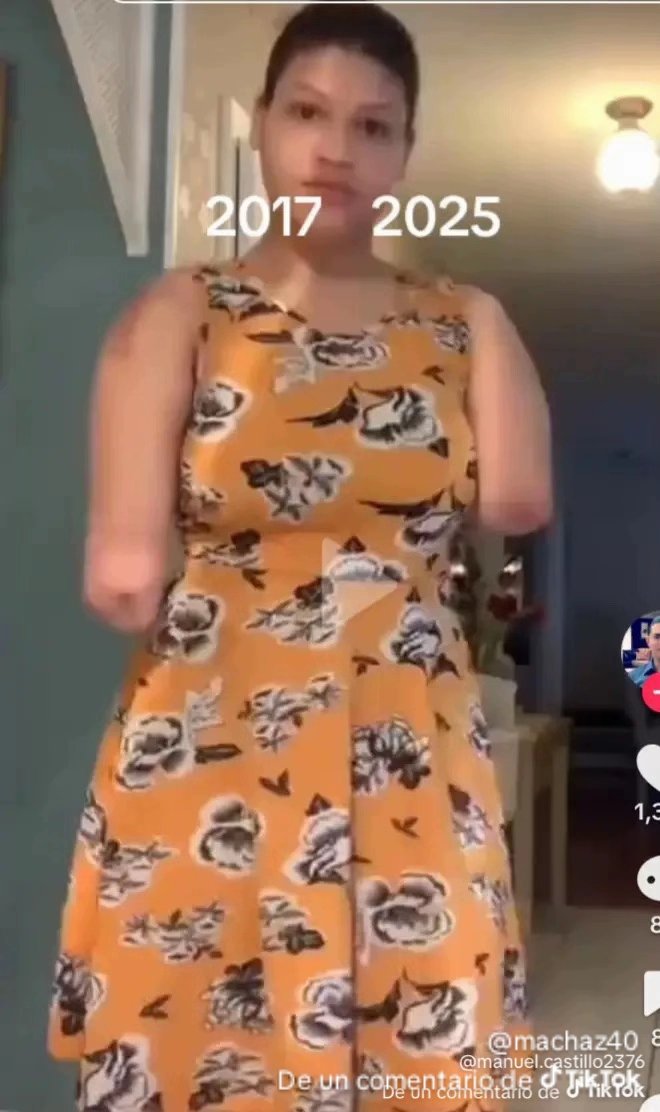 El odio que lo hatiano tiene por el dominicano es un odio muy profundo y grande lo cual mira como está chica pierde su futuro por culpa de un hatiano y el odio  profundo que le tiene al dominicano está una de muchas víctimas del odio que tiene el hatiano  <a href="/MichelFlorence7/">Florence MICHEL❤️🇭🇹</a>