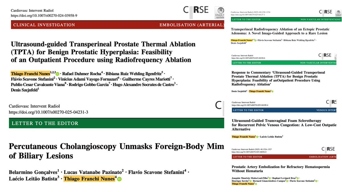 cirsesociety's tweet photo. #CIRSEtakeover @FranchiThiago
📚 RESEARCH & TEAMWORK in 2025 = #CVIR YEAR!
I am feeling truly honored to see our team’s dedication reflected in multiple publications throughout 2025 in @CVIR_Journal–the leading & most impactful journal in #interventionalradiology ⬇️
#Interventix https://t.co/ocWDI0fmeO