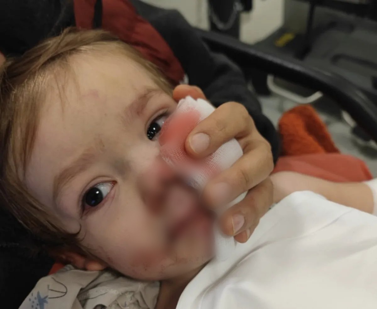 kocovalitr01's tweet image. Tek suçlu köpeğin sahibi değil❗

Bu köpek daha önce tasmasız ve ağızlıksız gezdirildiği için 12 defa şikayet edilmiş. Parkta bir kadına saldırıp yaralamış.

O kadar şikayete rağmen köpeğe el koymayan Ankara Dkmp ve Ankara Emniyeti yetkilileri hakkında niye işlem yapmıyorsunuz?