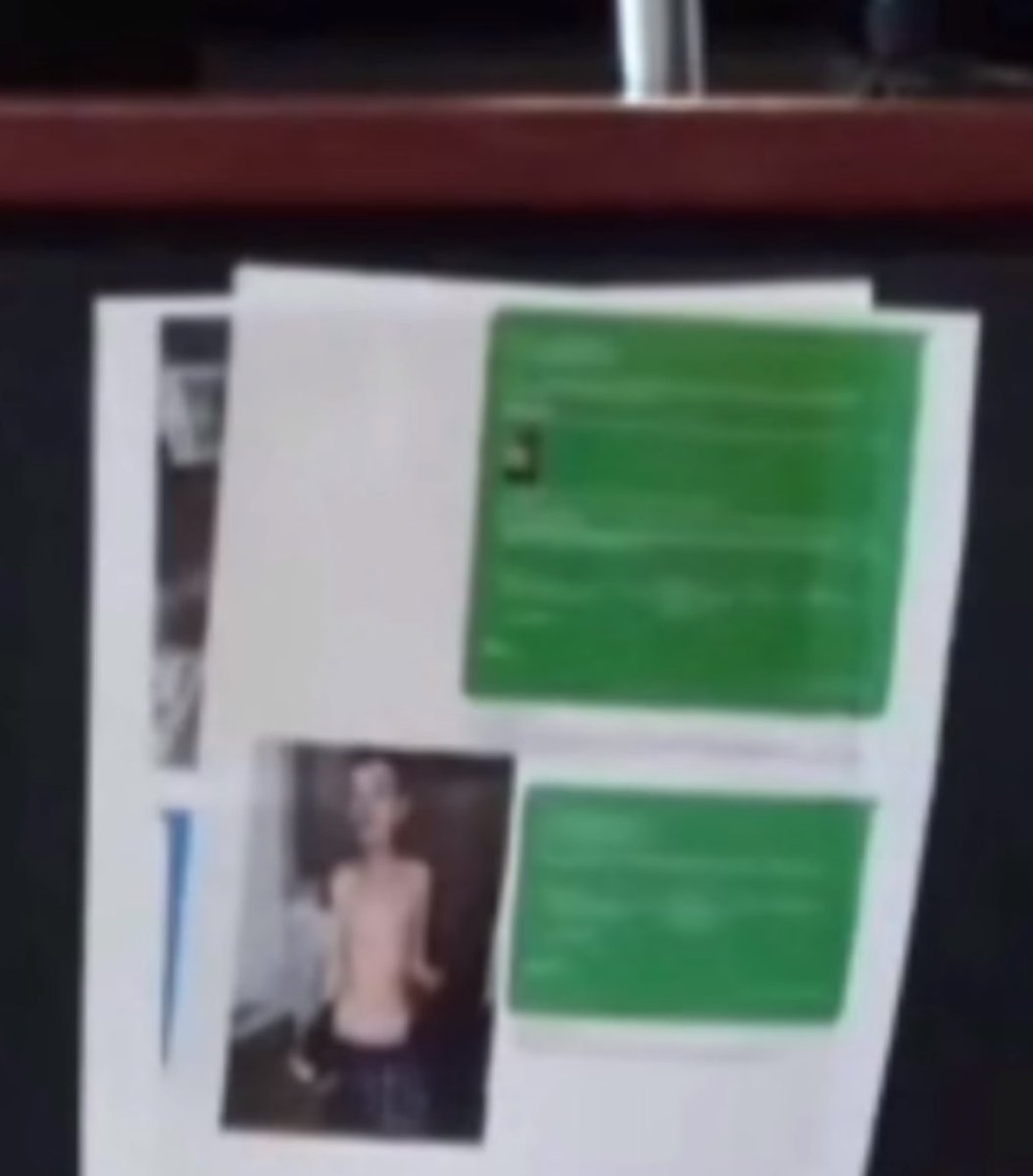 imadriienne's tweet photo. #TorturedSonMurderTrial #ShandaVanderArk #PaulFerguson #TimothyFerguson
🚨 GRAPHIC / UPSETTING ‼️
I honestly cannot believe what this woman did to this poor boy, 15 years old! 15! & when found, Timothy Ferguson weighed just over 60 pounds - merely skin & bones, inside a closet. She gave Timony bread & hot sauce! & other forms of brutal abuse. As Judge Kacel said “Let’s call it what it is, it is torture!”
Judge Kacel also said “I’m choosing also not to remember your son dead, and looking like a holocaust victim - I’m choosing to remember him like that! A beautiful child with alot of life in his eyes!”
Listen to Shanda’s testimony & also, Judge Kacel’s final remarks to her 🥺👇🏼
Also, this is the photo she was shown where she done the dramatic sick in front of the jury! (graphic/upsetting) ⚠️👇🏼
Shanda’s new trial hearing date is pending📌
👇🏼👇🏼