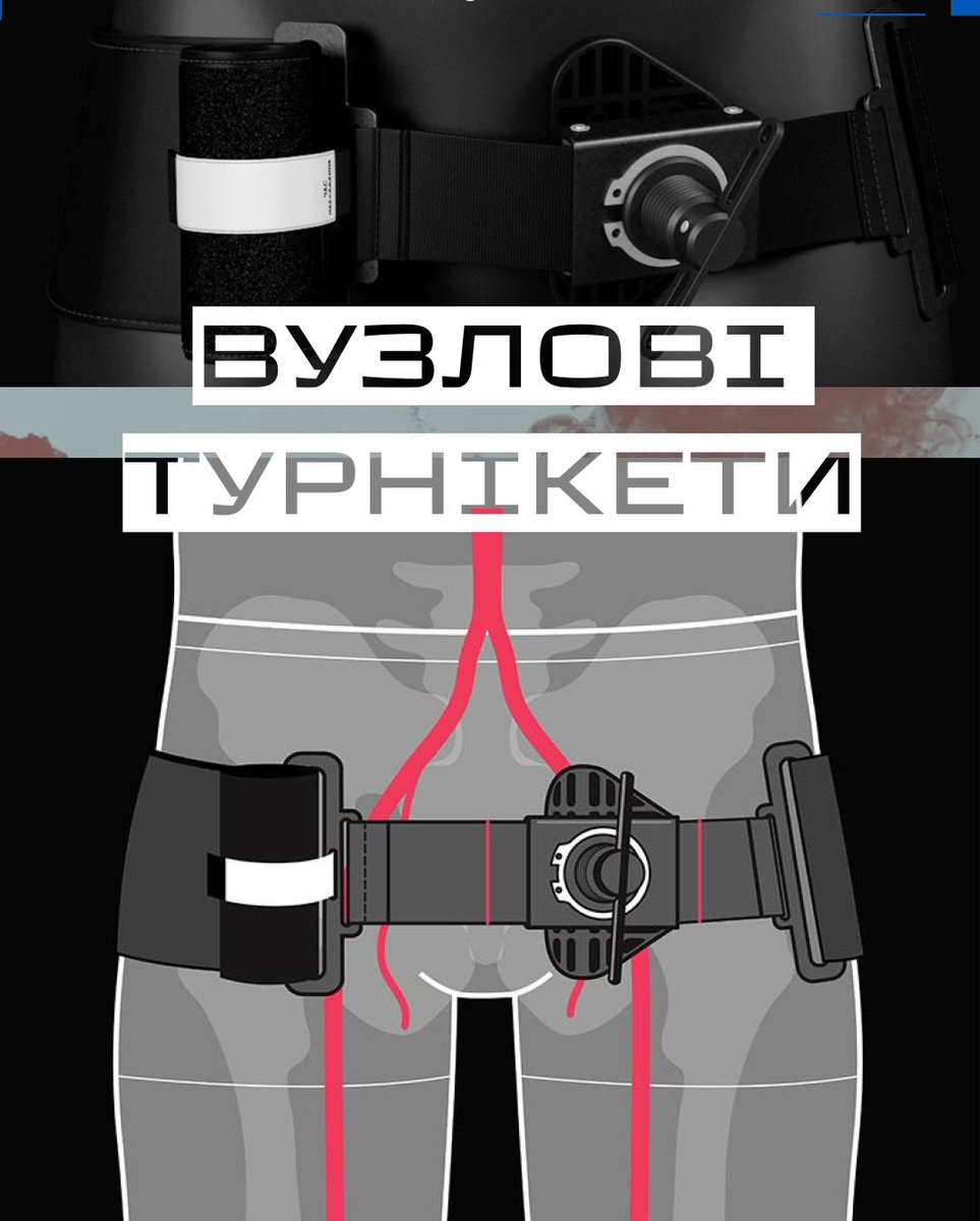 Допомагаємо з <a href="/AlinaBulochka/">📚Булочка любить книги і тебе</a> зібрати на партію вузлових турнікетів для медиків 59 ОШБр, що працюють на Покровському.

Наша ціль 30000 і за донат кратний 100грн ми розіграємо Kindle Basic в кольорі Matcha (з опцією без реклами)

send.monobank.ua/jar/2vercmNLop