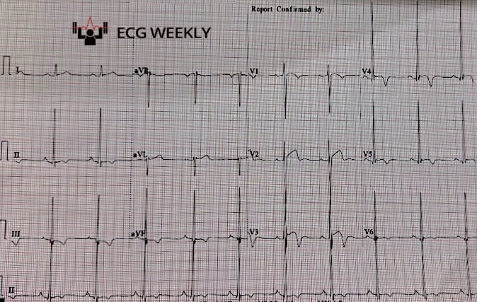 ECGWeekly tweet media