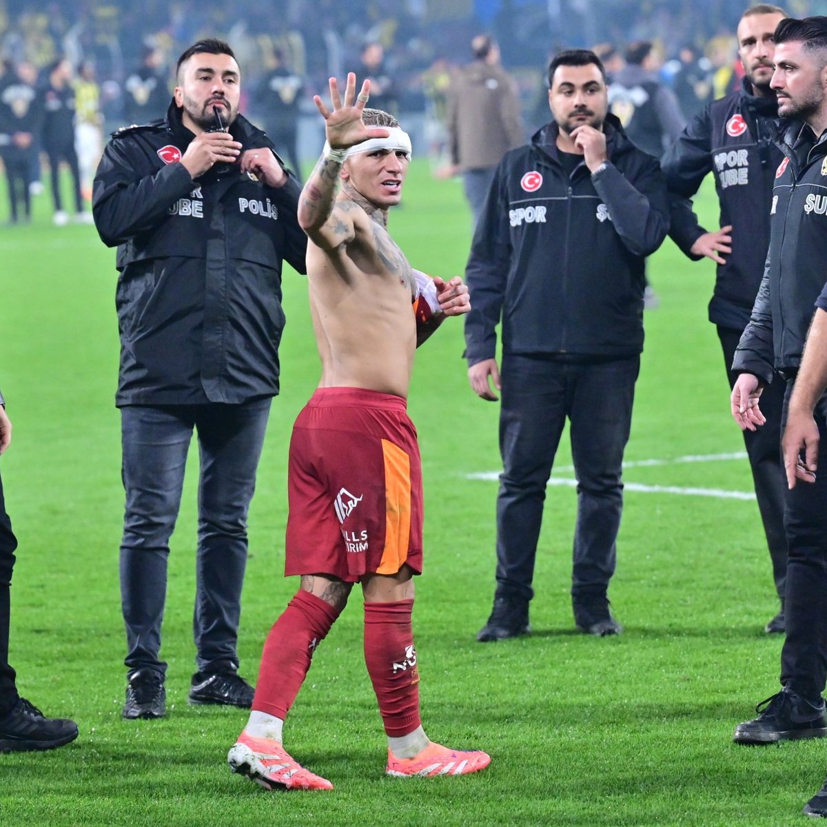 forzacimbom's tweet photo. 🤕 Maç sonu Lucas Torreira. https://t.co/35Ti5r5Fqw