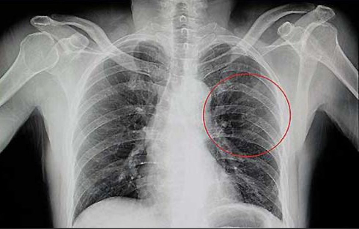 Brutalidad policiaca en la Feria: levantan, golpean y torturan a joven… luego dicen “nos equivocamos”

Denuncian un grave caso de brutalidad policiaca durante el concierto de Los Tigres del Norte en la feria.
Un joven fue esposado, aislado y golpeado con un tolete por policías