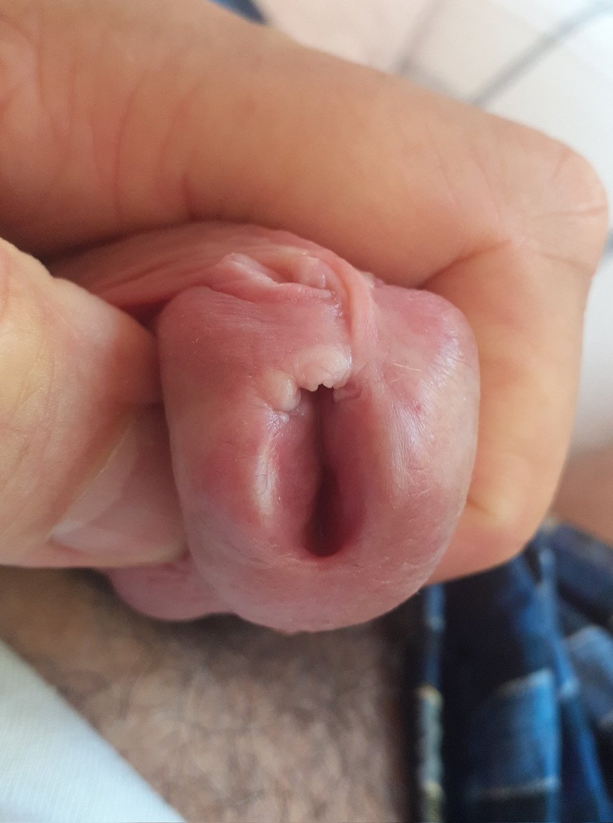 🇩🇪💦🍌✂️🐓UncutSounderPA😈🔥 tweet media