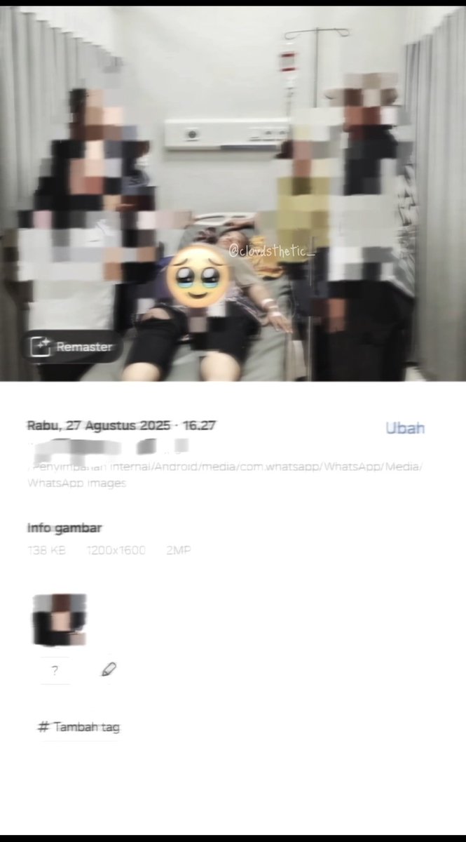 clovdsthetic_'s tweet image. [2025/08/27]
Siangnya masih ngopi, sorenya kecelakaan 🫣 hari sial gada dikalender ygy 😊