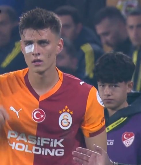 Emrah Kayalıoğlu: "Maraton tribünden Kazımcan'a neredeyse gözünü çıkaracak maddeyi atan hayvanı ödüllendiren Yasin Kol... Ne demek yabancı maddeyle yaralanan futbolcuyu saha dışına çıkarmak, nasıl bir kafa bu."