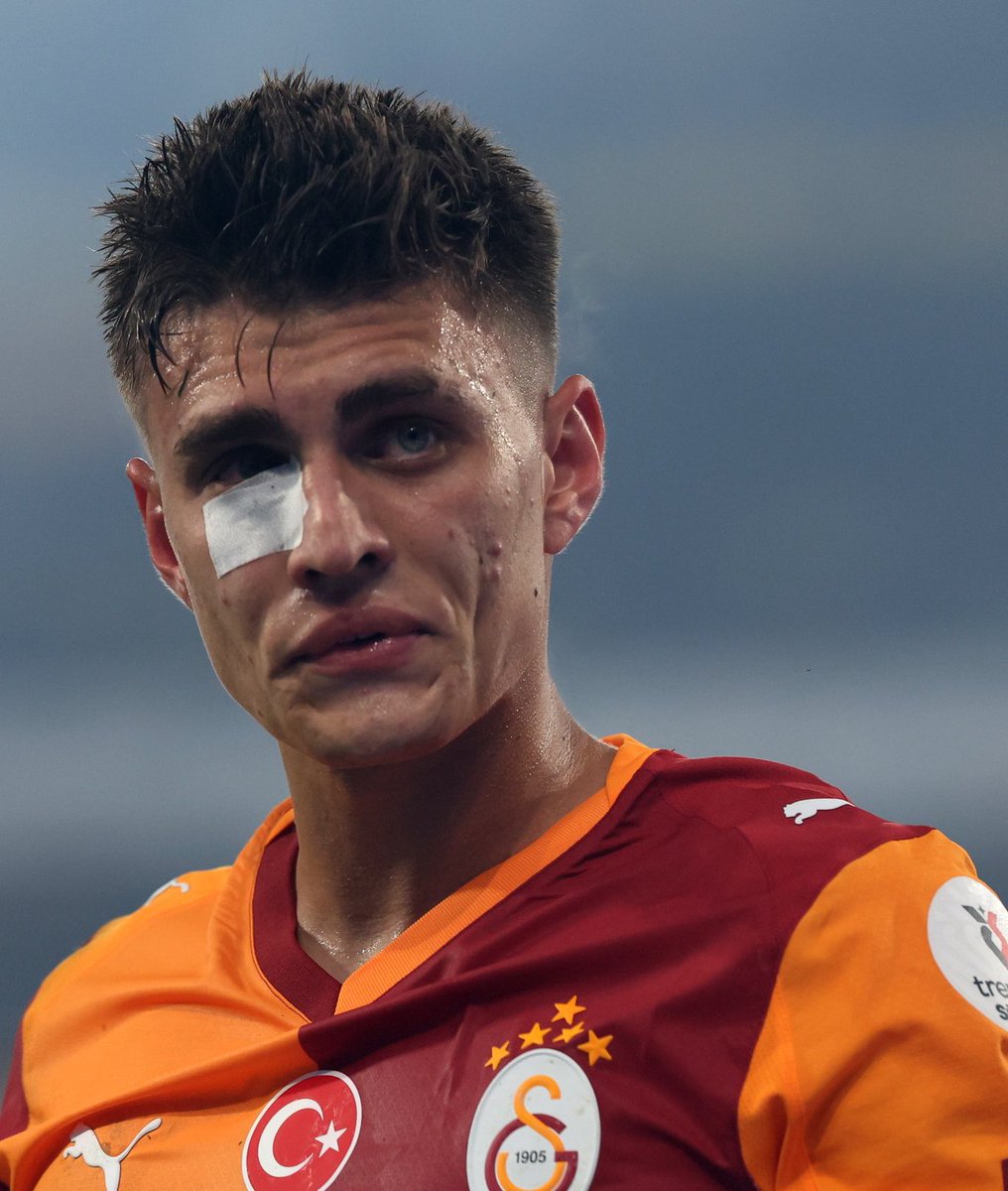 Çocuğun gözüne gelse belki de kör kalacak futbolculuk kariyeri bitecek.

Yazıklar olsun sizin gibi taraftara..