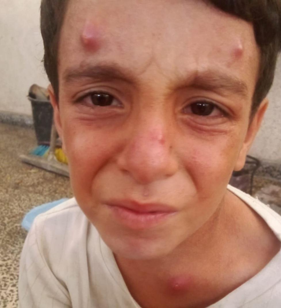 💔Adam is suffering from a contagious rash due to the pollution dirt and dust in his environment His condition is worsening day by dayand I can't afford treatment or cleaning supplies Please help me so I can treat him🙏

 Even a dot would be appreciated

gofundme.com/f/support-rose…