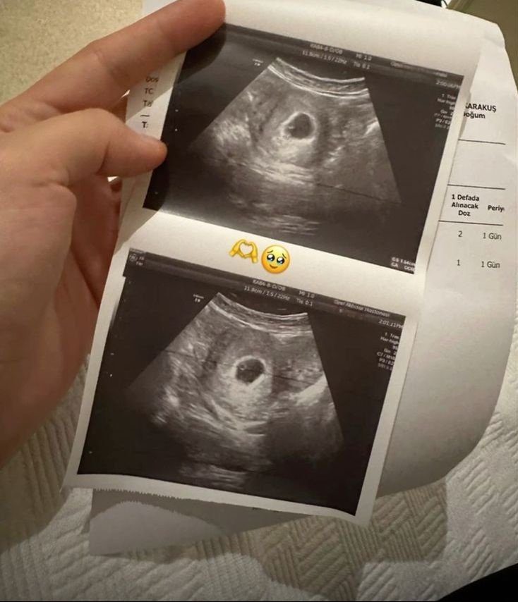 No one cares about us.. just because we're from Gaza.

I'm about to give birth.All I ask for is my right to a safe delivery and my child's right to a life free from terror.

If you have even a shred of compassion in your heart, don't ignore my suffering⬇️

gofund.me/4b903cc2