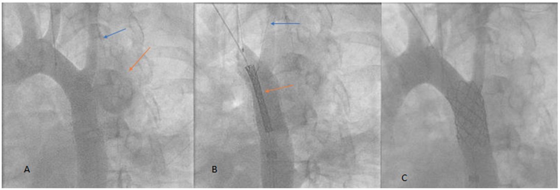 Congenital Cardiology Today tweet media