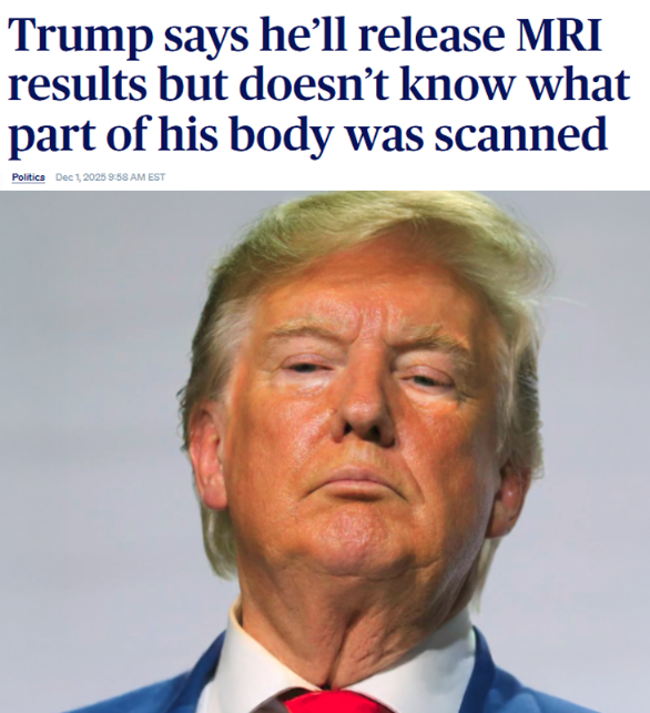 AwesomeNewsom's tweet image. WE&apos;RE HEARING IT WAS AN MRI OF THE NECK ORDERED BY HIS GYNECOLOGIST.