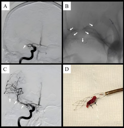 Journal of Neuroimaging tweet media